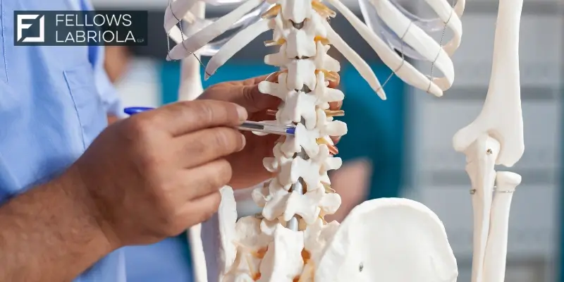 Expert Atlanta Spinal Cord Injury Attorney Expert Atlanta Spinal Cord Injury Attorney