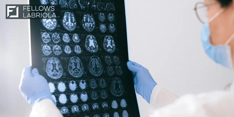 Expert Jonesboro Traumatic Brain Injury Attorney