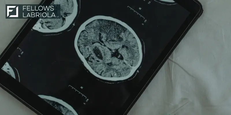 What To Expect in a Traumatic Brain Injury Lawsuit (2025)