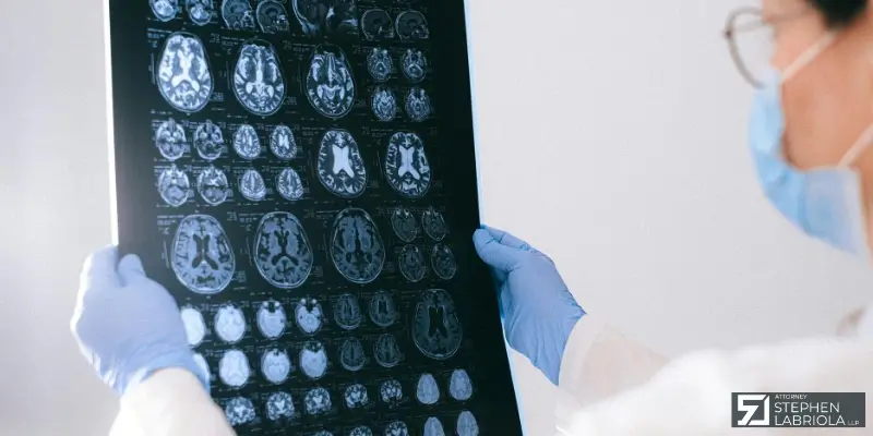 Trusted Jonesboro Traumatic Brain Injury Attorney